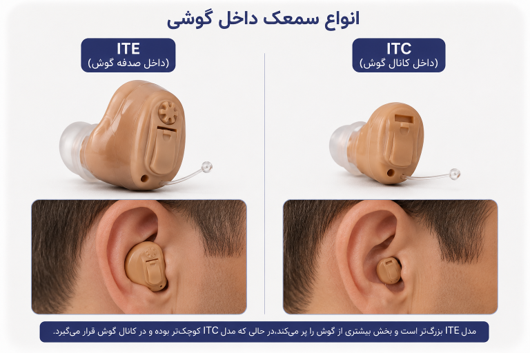 انواع سمعک داخل گوشی ITE و ITC